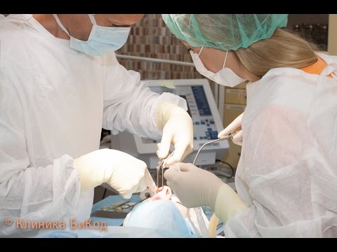 Видео: Ринопластика / пластика носа. Вся процедура без прикрас в Клинике БиКод!