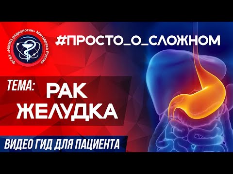 Видео: ПРОСТО_о_СЛОЖНОМ  РАК ЖЕЛУДКА