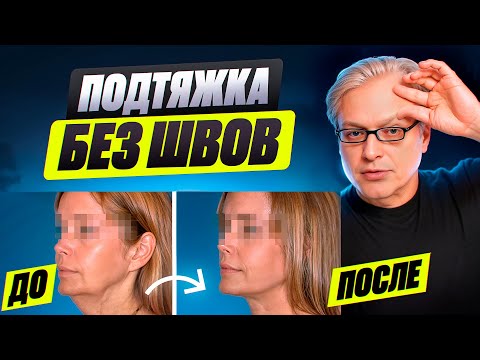 Видео: Эндоскопический лифтинг