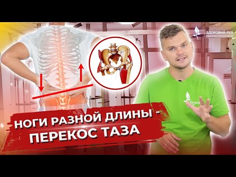 Видео: Ноги разной длины-перекос таза