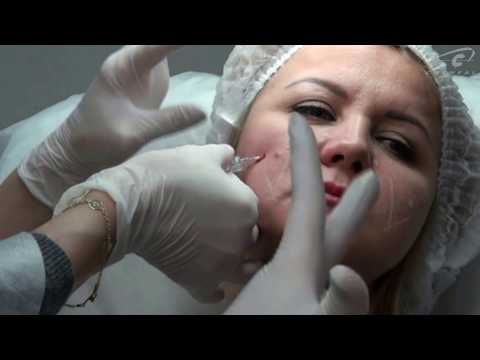 Видео: Что делать, если в первый раз взял в руки канюлю? Мастер-класс по контурной пластике "Корнеаль"