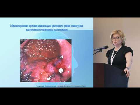Видео: Эндоскопические резекции при раннем раке желудка
