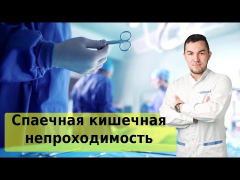Видео: Спаечная кишечная непроходимость