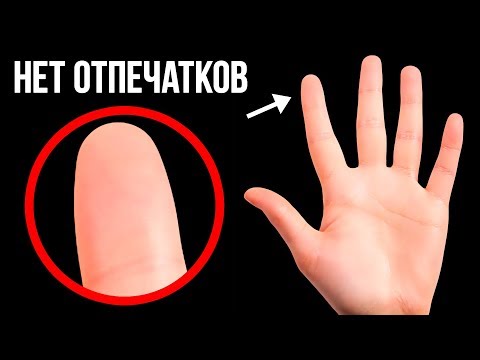 Видео: Что, если бы у нас не было отпечатков пальцев