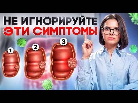 Видео: Ранние симптомы рака ЖКТ к которым мы относимся НЕСЕРЬЕЗНО