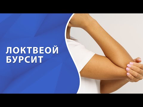 Видео: Бурсит локтевого сустава // Бурсит локтя // Болезни суставов #бурсит