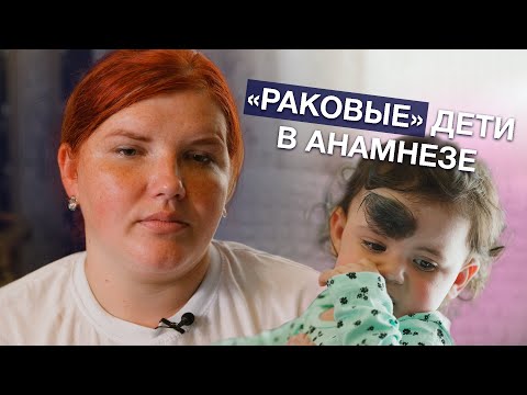 Видео: ПИГМЕНТНЫЙ НЕВУС | История Раяны Михайловой