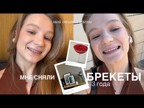 Видео: МНЕ СНЯЛИ БРЕКЕТЫ! | сложности, слезы и моя история 