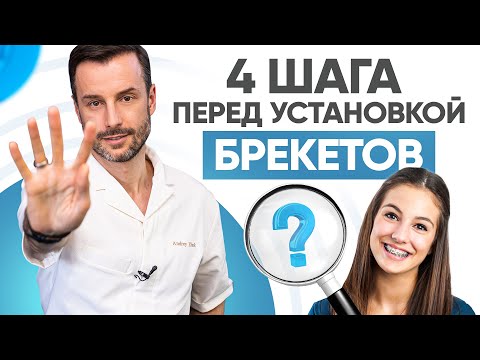 Видео: 4 важных шага перед установкой брекетов. Современная ортодонтия