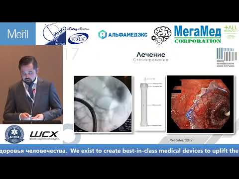 Видео: Назаров И. Низкая кишечная непроходимость