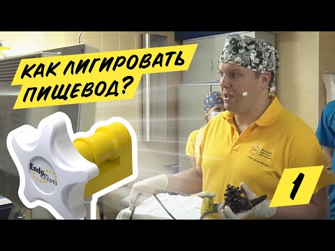 Видео: Эндоскопическое лигирование ВРВП, клинический случай №1, МКНЦ 23.01.19