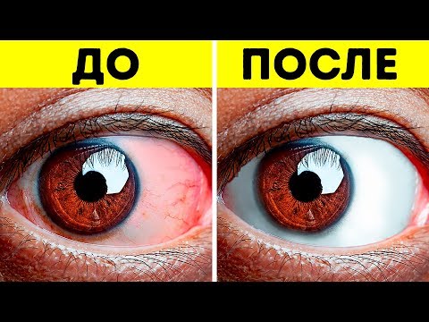 Видео: 14 упражнений, которые позволят снять усталость с глаз