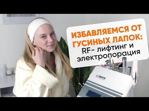 Видео: Избавляемся от гусиных лапок: RF-лифтинг и электропорация