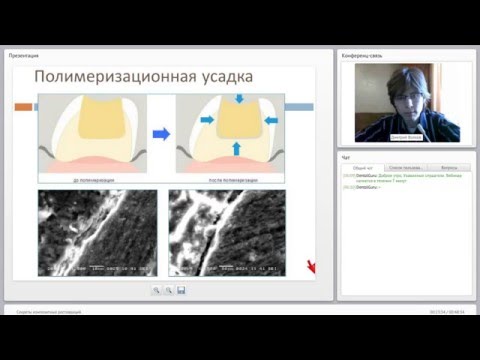 Видео: 2015 03 17 Секреты композитных реставраций  0001