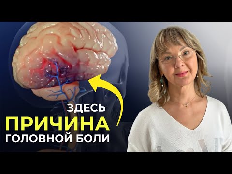Видео: Постоянные головные боли. Изменения на МРТ. Лекарства не помогают