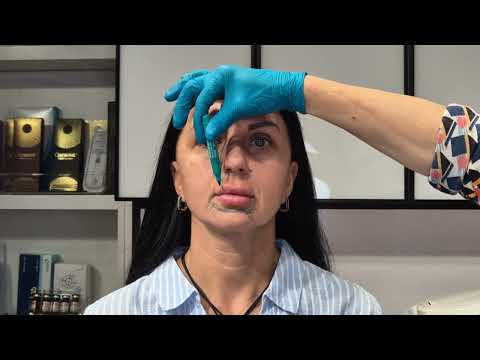 Видео: Комплексная коррекция. Алгоритм. Нюансы.