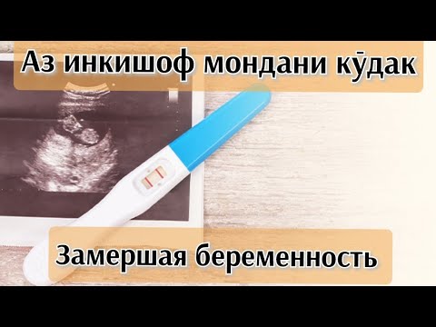Видео: Задержка развития ребёнка. Причины задержки развития ребёнка #развитиеребёнка #здороваяжизнь