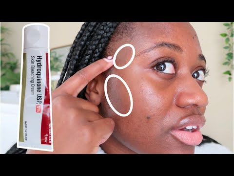 Видео: МОЖЕТ ЛИ ГИДРОХИНОН ИЗБАВИТЬСЯ ОТ ГИПЕРПИГМЕНТАЦИИ? 🤔 | 3 МЕСЯЦА ИСПОЛЬЗОВАНИЯ 4% ГИДРОХИНОНА