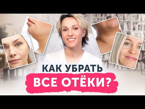 Видео: Как убрать ВСЕ отёки? 6 видов отёков лица и борьба с ними