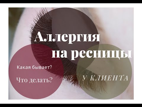 Видео: Аллергия на наращивание ресниц у клиента - самое полное видео