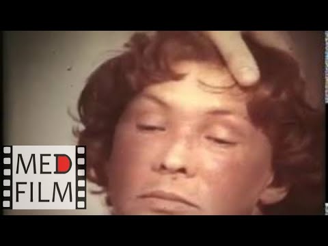 Видео: Рожа © Еrysipelas