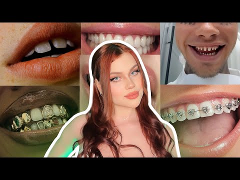 Видео: ЗУБЫ, как модное явление: почему даже это стало трендом?