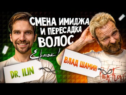 Видео: Пересадка волос у вокалиста группы Ермак! Подкаст| Влад Шамин| Матвей Ильин