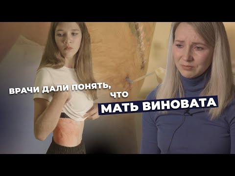 Видео: РУБЦОВАЯ ДЕФОРМАЦИЯ ТЕЛА ПОСЛЕ ОЖОГОВ | История Яны Муканиной