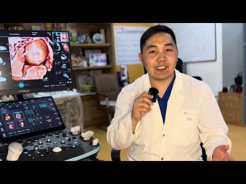 Видео: 20 долоо хоногтой жирэмсэн бол үзээрэй