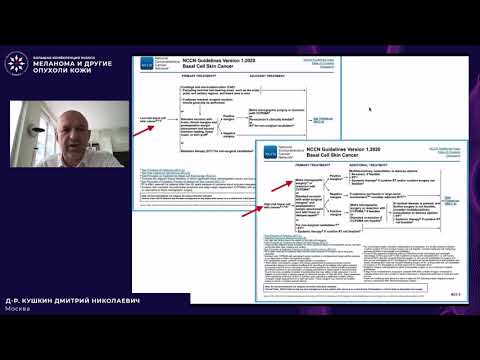 Видео: Базальноклеточный рак кожи – современные подходы к лечению первичных и рецидивных опухолей