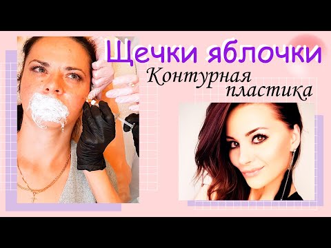 Видео: Щечки яблочки / контурная пластика / видео урок