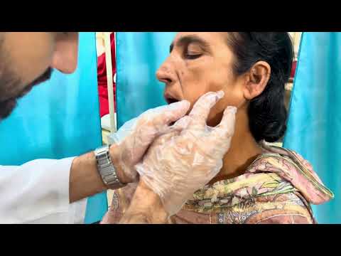 Видео: Осмотр околоушной железы