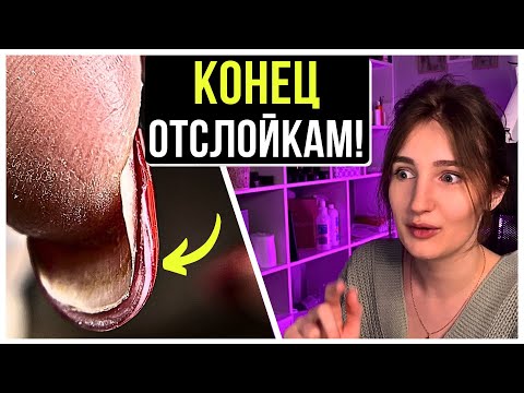 Видео: НАКОНЕЦ-ТО НАШЛА ПРИЧИНУ ОТСЛОЕК! ПОЛНОСТЬЮ отслоились ВСЕ НОГТИ!