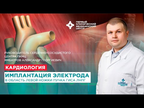 Видео: Имплантация электрода в область левой ножки пучка Гиса ЛНПГ