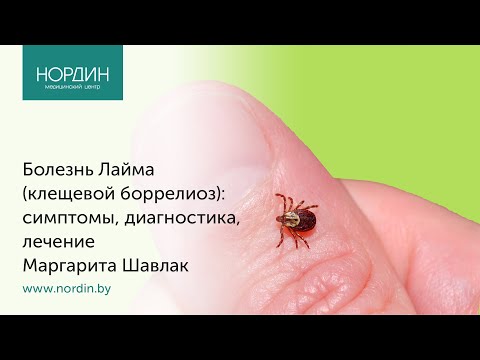 Видео: Болезнь Лайма (клещевой боррелиоз): симптомы, диагностика, лечение