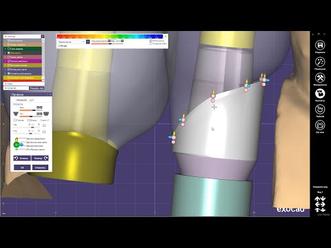 Видео: EXOCAD Работа с профилем прорезывания, коронки на винтовой фиксации