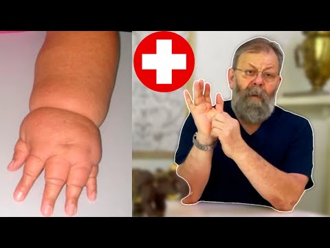 Видео: ОТЁКОВ БОЛЬШЕ НЕ БУДЕТ СУЩЕСТВОВАТЬ В НАШЕЙ ЖИЗНИ!