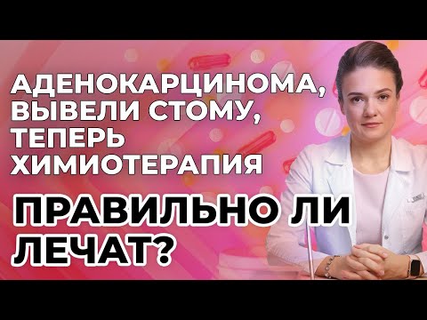 Видео: Аденокарцинома, вывели стому, теперь химиотерапия. Правильно ли лечат?