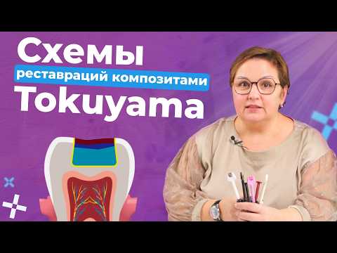 Видео: Как наносить композиты Tokuyama?