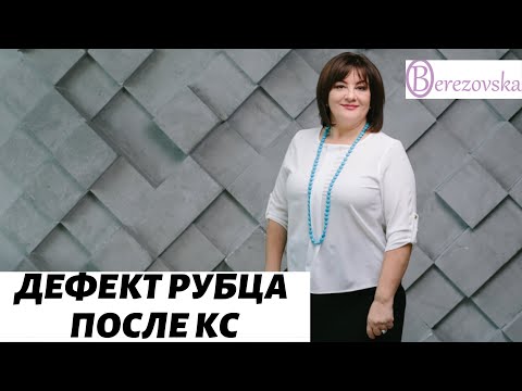 Видео: Дефект рубца после КС @DrOlenaB