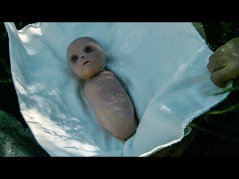 Видео: Он родился без рук, ног, глаз и внутренних органов