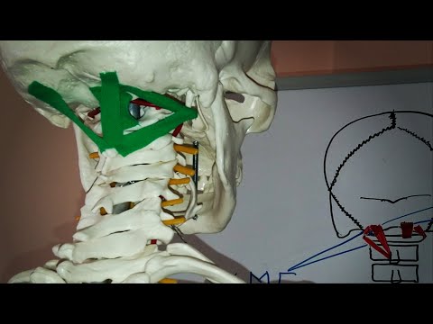 Видео: Головокружение. Боль в затылке. Позвоночная артерия. Короткие разгибатели шеи