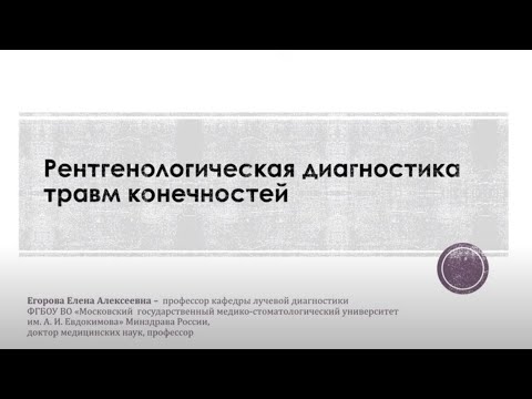 Видео: Рентгенологическая диагностика травм конечностей