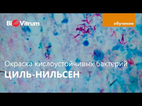 Видео: Циль - Нильсен: теория и практика