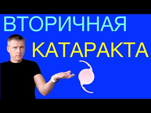 Видео: Вторичная катаракта: лечение лазером. Как избавиться от вторичной катаракты.