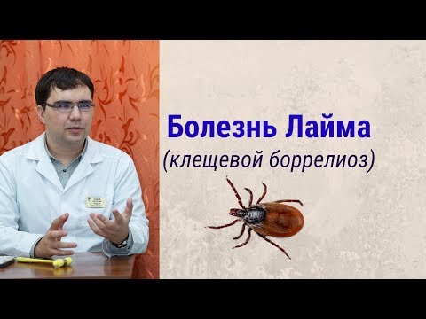 Видео: Болезнь Лайма (клещевой боррелиоз): симптомы. диагностика, лечение