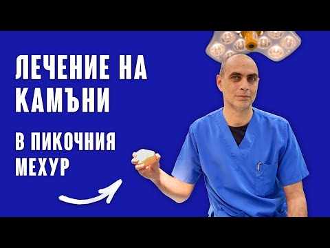 Видео: Камъни в Пикочния Мехур... Кой е най-добрият метод за лечение и разбиване?!