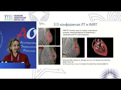 Видео: Современные технологии лучевой терапии на пути к снижению кардиотоксичности