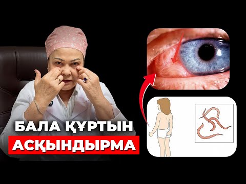 Видео: Баладағы құртты емдеу | Iштегі паразиттерді қалай кетіруге болады?