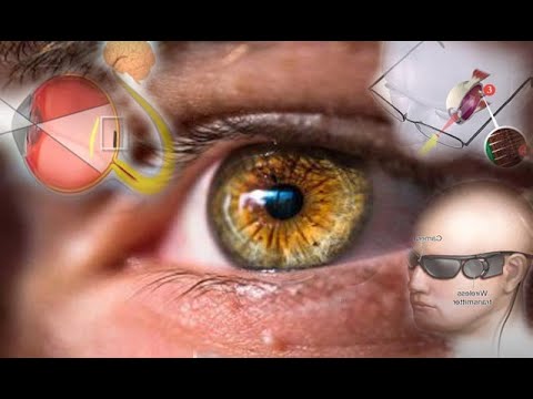 Видео: Бионический глаз, которому позавидует человек